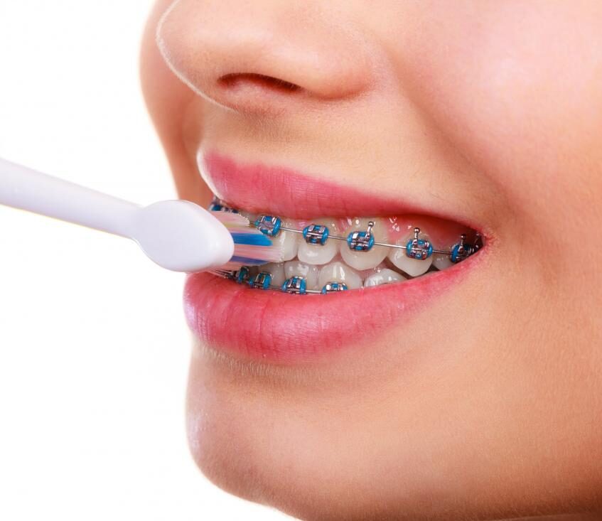 ارتودنسی دندان