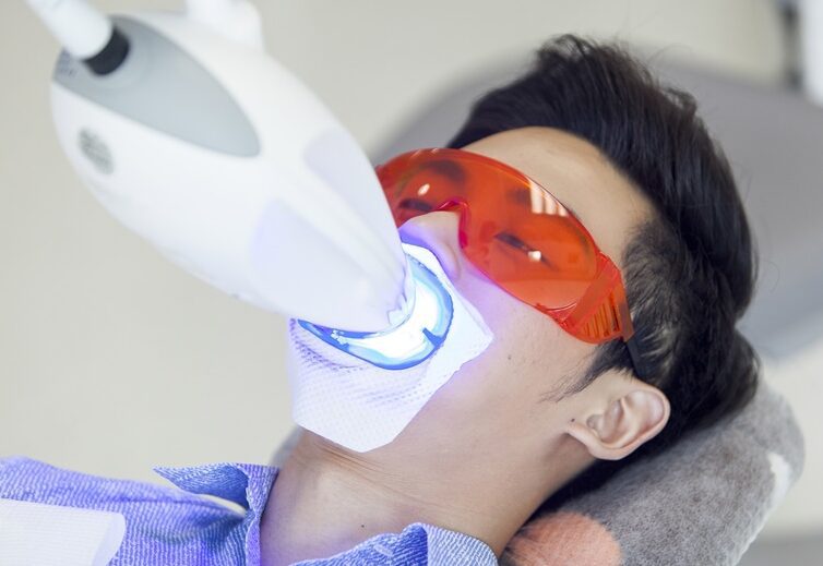 بلیچینگ دندان با لیزر در ساری