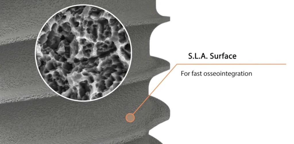 ایمپلنت ایمپلنتیوم با سطح S.L.A