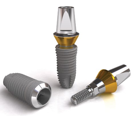 ایمپلنت های دندانی ایمپلنتیوم