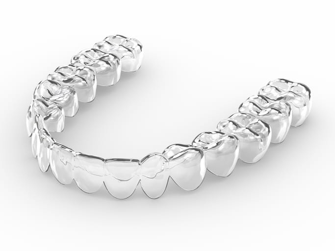 نگهدارنده ارتودنسی متحرک شفاف (Essix Retainer)