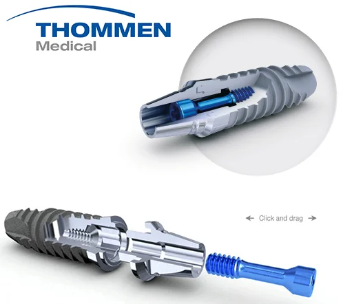 Thommen Medical با برند SPI 