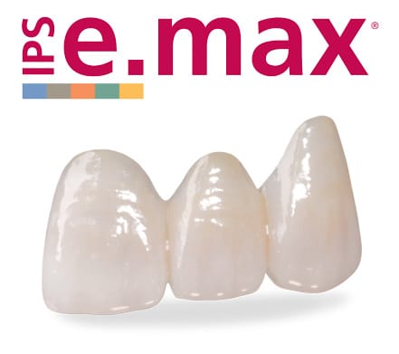 روکش ایمکس E-MAX