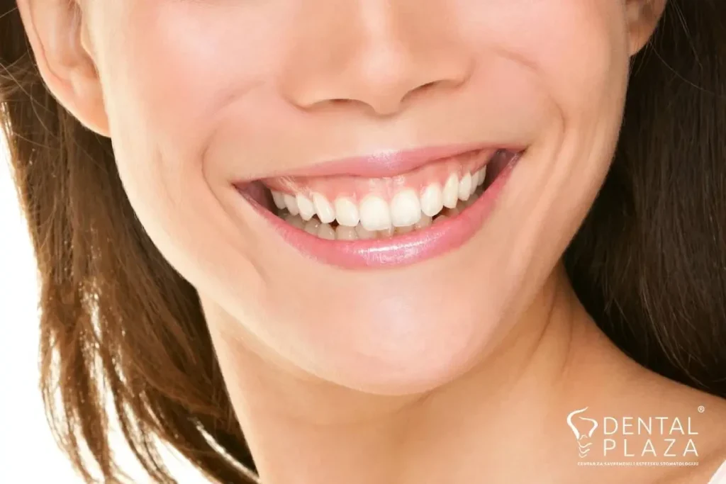لبخند لثه ای چیست