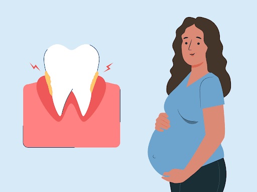 بیماری های پریودنتال