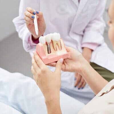 افزایش طول عمر ایمپلنت دندان