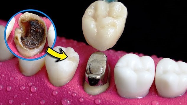 دندانپزشکی در ساری