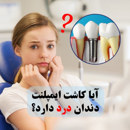 آیا کاشت ایمپلنت دندان درد دارد؟