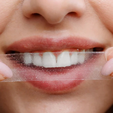 سفید کردن دندان در خانه