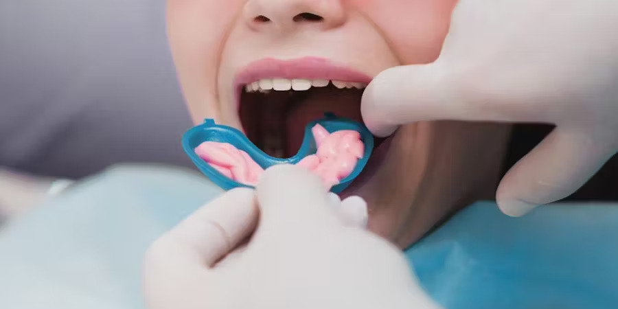 فلورایدتراپی