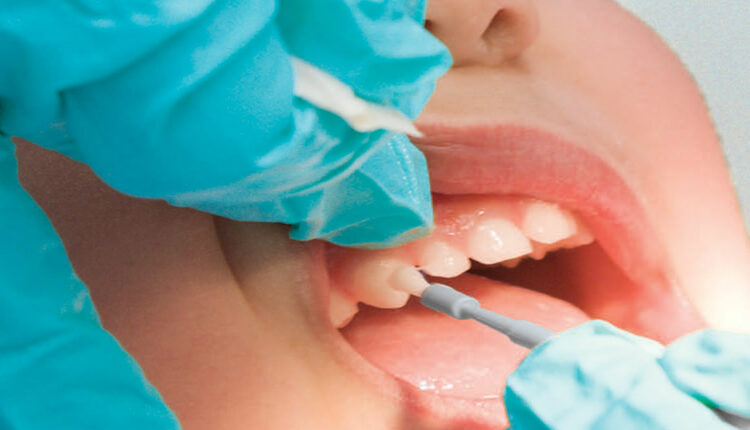 درمان حساسیت دندان