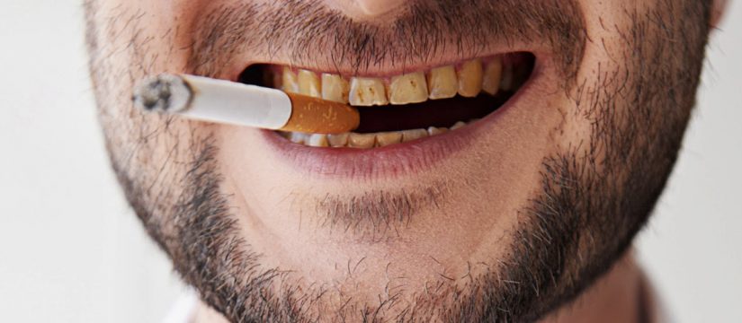 تغییر رنگ دندان ها