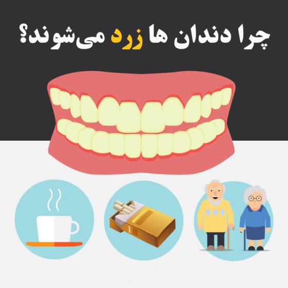 چرا دندان ها زرد می‌شوند؟