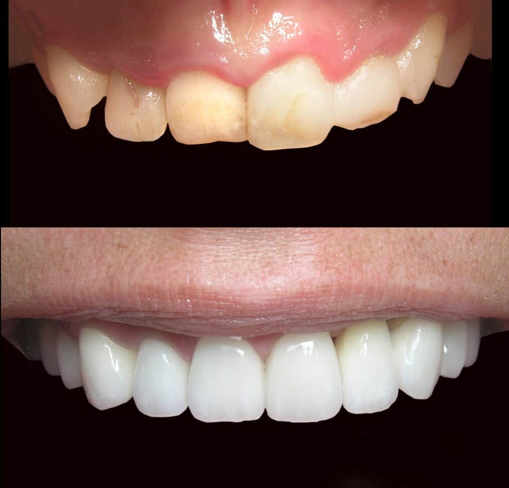 دندانپزشکی ترمیمی و زیبایی در ساری