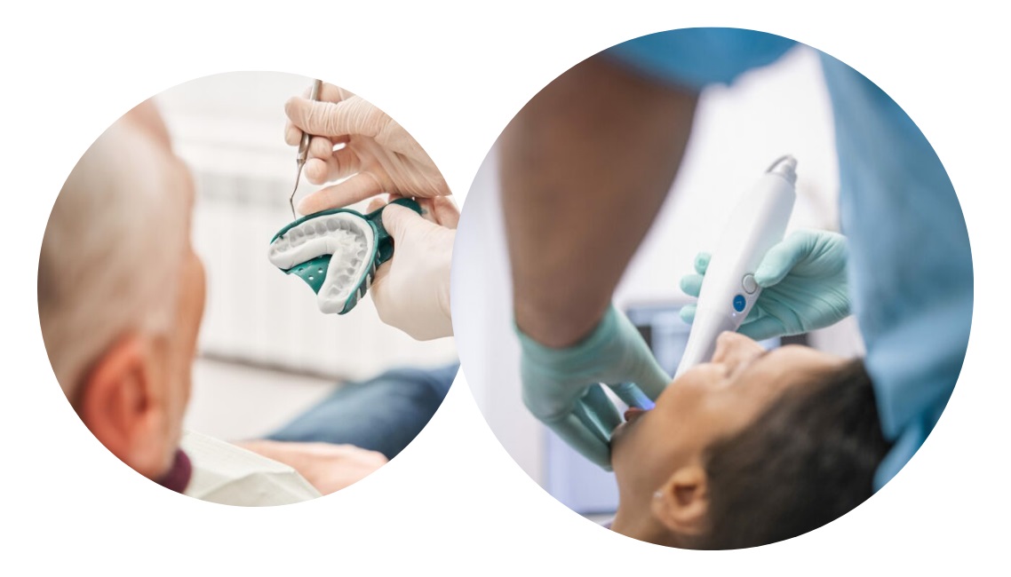 اسکنر داخل دهان