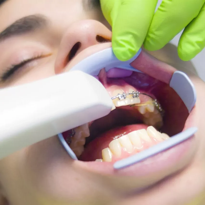 کاربرد اسکنر دیجیتال در ارتودنسی