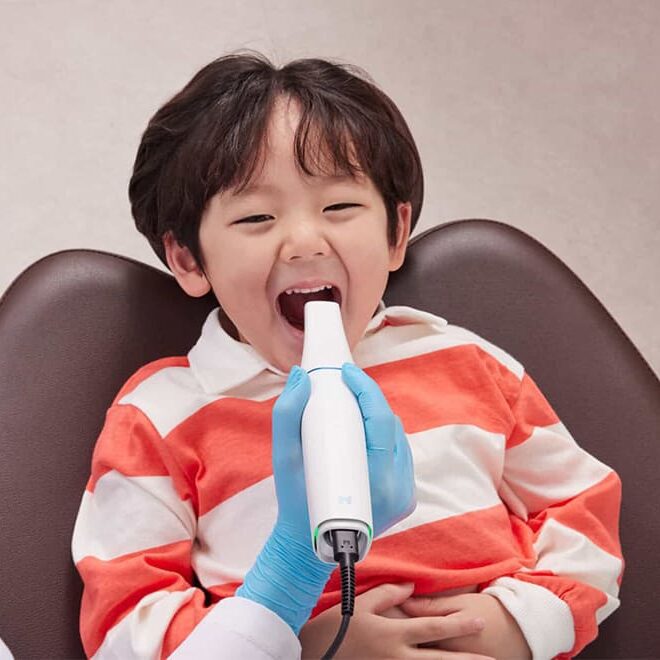 اسکنر سه بعدی در دندانپزشکی کودکان