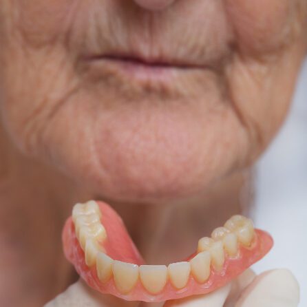 عوارض بی دندانی بر زیبایی صورت