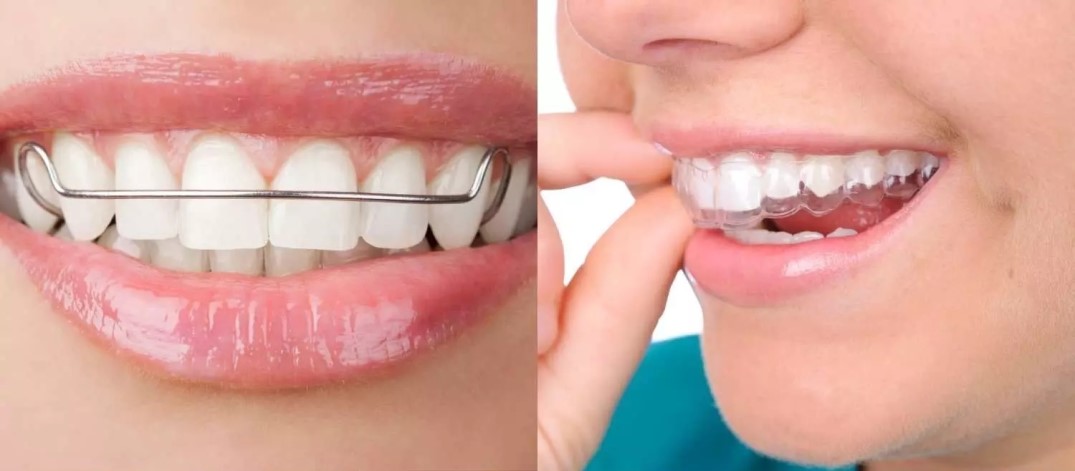 مراقبت های بعد از ارتودنسی دندان