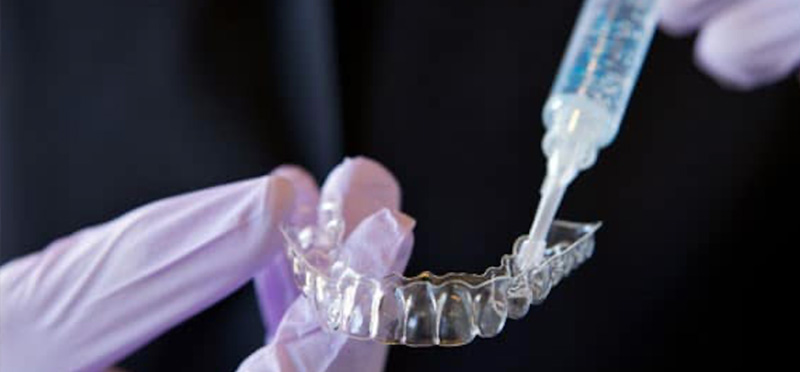 سفید کردن دندان در خانه