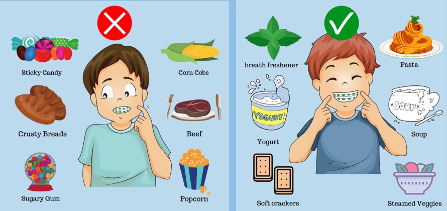 مراقبت از دندان در طول ارتودنسی؛ چگونه از پوسیدگی دندان جلوگیری کنیم؟