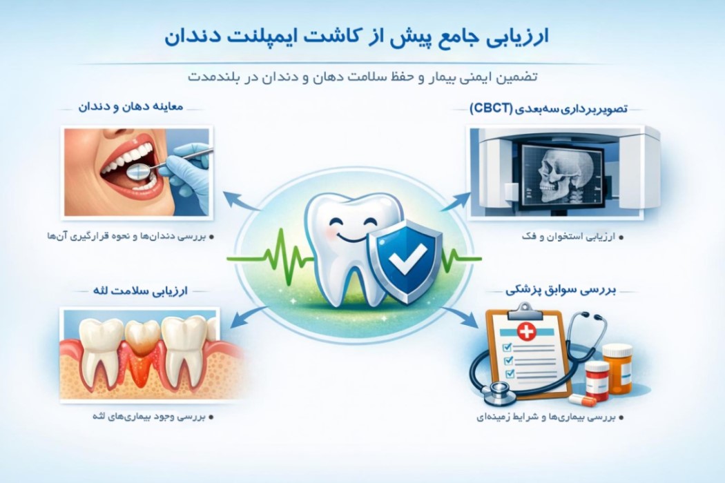 بیماری های مانع کاشت ایمپلنت