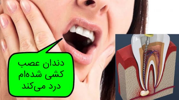 درمان ریشه