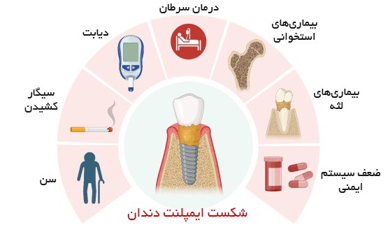 بیماری های مانع کاشت ایمپلنت
